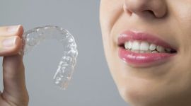 יישור שיניים INVISALIGN גששר שקוף